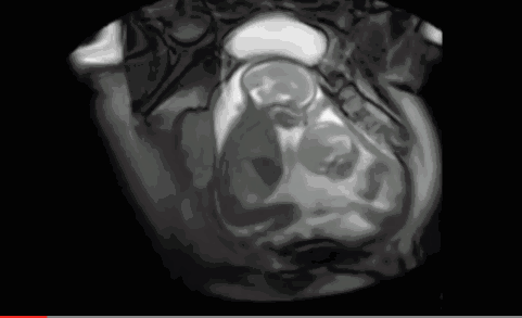 20201118103938882470.gif timg.gif
